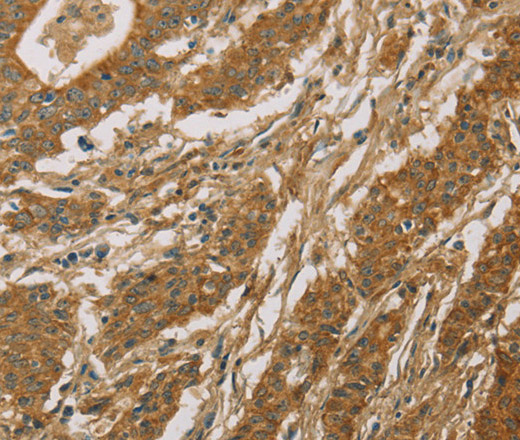 CYP39A1 Polyclonal Antibody (E-AB-14913)