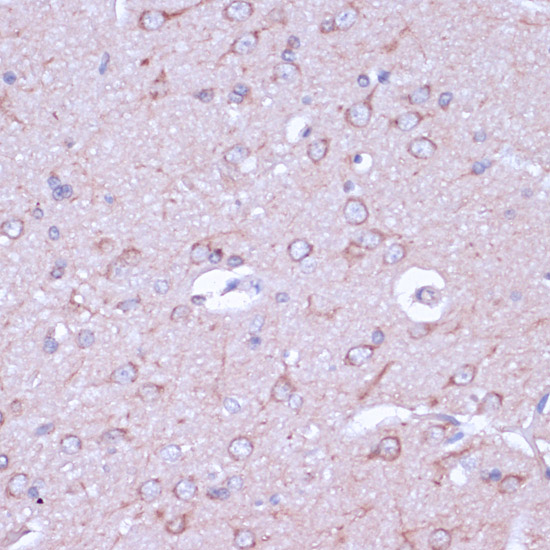 PRKACB Polyclonal Antibody (E-AB-60899)