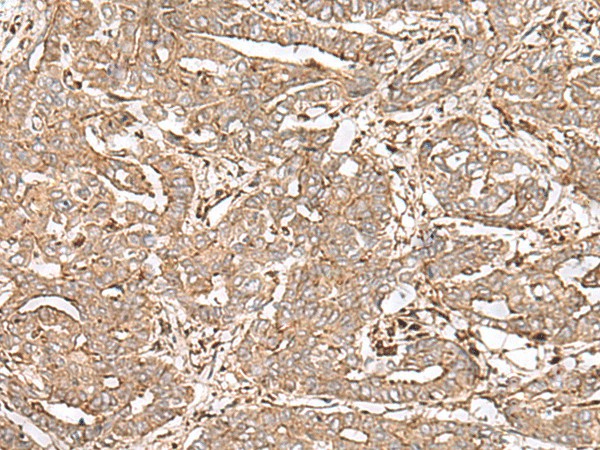 FAAP24 Polyclonal Antibody (E-AB-17929)