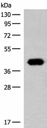 GIPC1 Polyclonal Antibody (E-AB-19910)