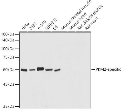 PKM2-specific Polyclonal Antibody (E-AB-92125)