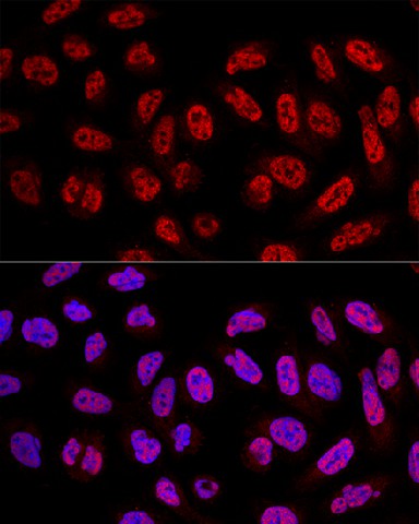 SF3A3 Polyclonal Antibody (E-AB-62365)
