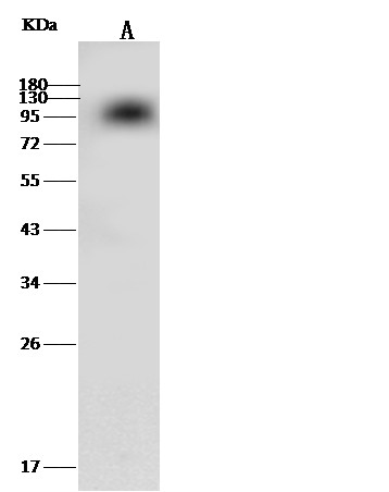 Recombinant Coagulation Factor II/F2 Monoclonal Antibody (AN300512P)