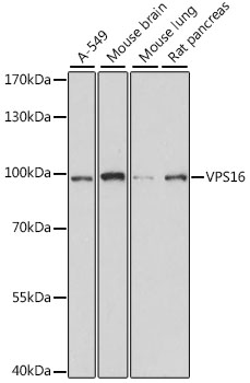 VPS16 Polyclonal Antibody (E-AB-66615)