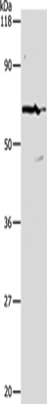 PKM Polyclonal Antibody (E-AB-10004)