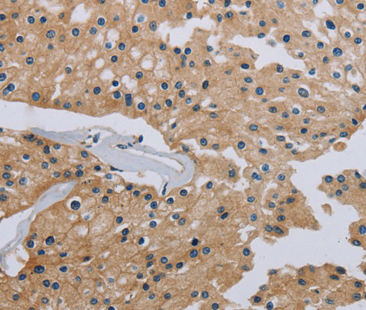 HSD3B7 Polyclonal Antibody (E-AB-11311)