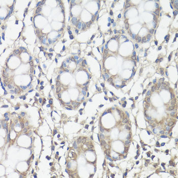 FAK Polyclonal Antibody (E-AB-64069)