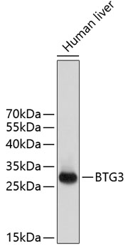 BTG3 Polyclonal Antibody (E-AB-92481)