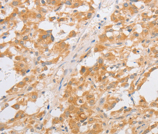 CDKN2AIP Polyclonal Antibody (E-AB-10510)