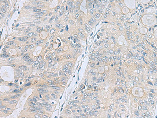 APOBR Polyclonal Antibody (E-AB-19734)
