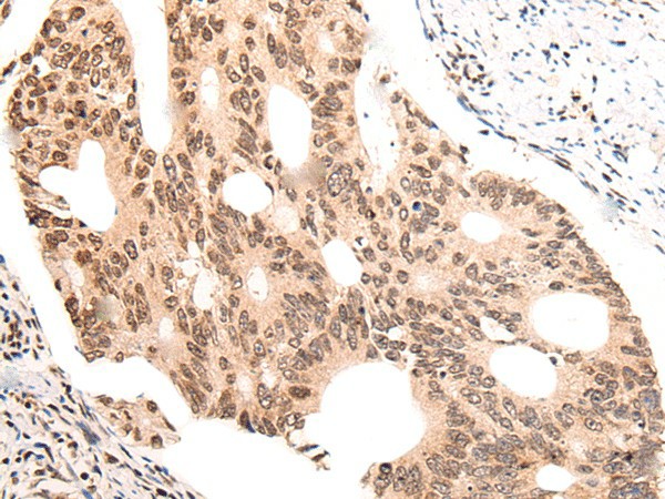 KNOP1 Polyclonal Antibody (E-AB-19638)