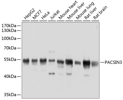 PACSIN3 Polyclonal Antibody (E-AB-63891)