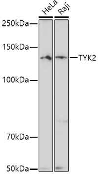 TYK2 Polyclonal Antibody (E-AB-93276)