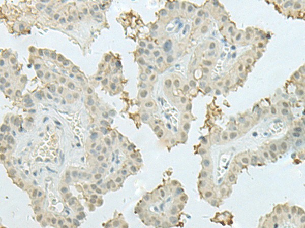 MECOM Polyclonal Antibody (E-AB-19826)