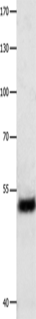 EEF1 gamma Polyclonal Antibody (E-AB-14056)