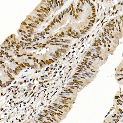 SETMAR Polyclonal Antibody (E-AB-61336)