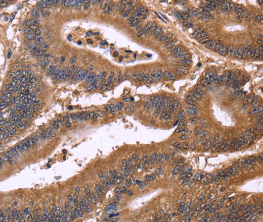 CDC37L1 Polyclonal Antibody (E-AB-14855)