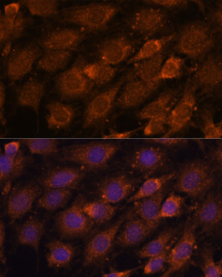 CREB3 Polyclonal Antibody (E-AB-61218)