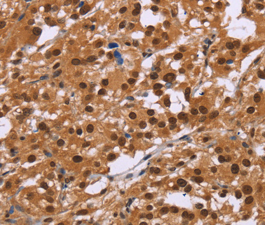 CTNNBL1 Polyclonal Antibody (E-AB-11110)