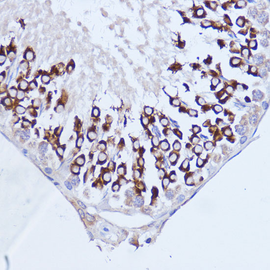 Polyclonal AntibodyPC1 Polyclonal Antibody (E-AB-65139)