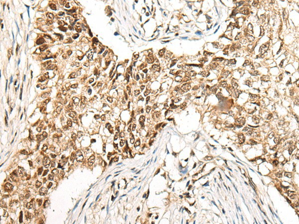 CCDC181 Polyclonal Antibody (E-AB-52493)