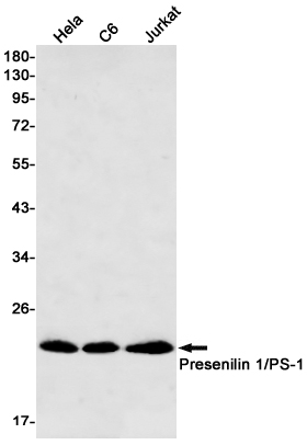 Recombinant Presenilin 1 Monoclonal Antibody (E-AB-81599)