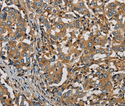 PLIN3 Polyclonal Antibody (E-AB-16702)