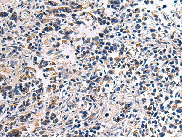 DRGX Polyclonal Antibody (E-AB-17892)
