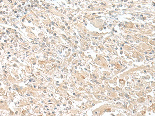 SMS Polyclonal Antibody (E-AB-18693)
