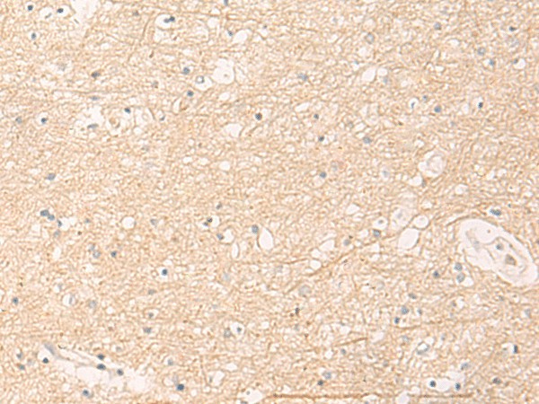 ELP1 Polyclonal Antibody (E-AB-52014)