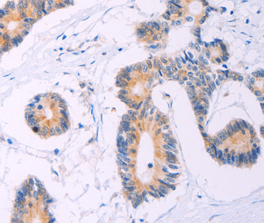 ADCY5 Polyclonal Antibody (E-AB-12950)