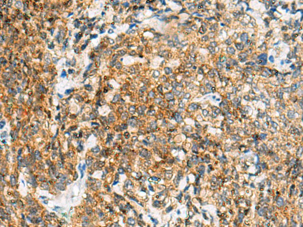 TUFT1 Polyclonal Antibody (E-AB-52622)