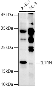 IL1RN Polyclonal Antibody (E-AB-92328)