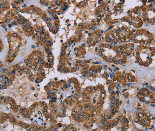 GRK1 Polyclonal Antibody (E-AB-12493)