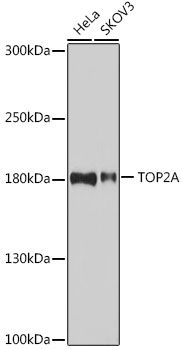 TOP2A Polyclonal Antibody (E-AB-66822)