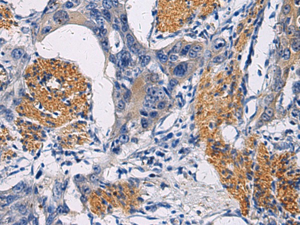 FAM20C Polyclonal Antibody (E-AB-19844)