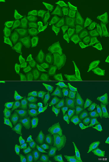 HAUS8 Polyclonal Antibody (E-AB-62560)