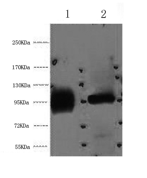 ABCB5 Monoclonal Antibody (E-AB-22032)