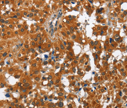 PAK2 Polyclonal Antibody (E-AB-10521)