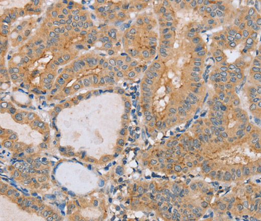 PTPN4 Polyclonal Antibody (E-AB-13543)