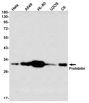 Recombinant Prohibitin Monoclonal Antibody (E-AB-81601)