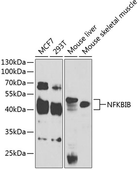 NFKBIB Polyclonal Antibody (E-AB-68381)