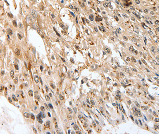 SLC1A7 Polyclonal Antibody (E-AB-16060)