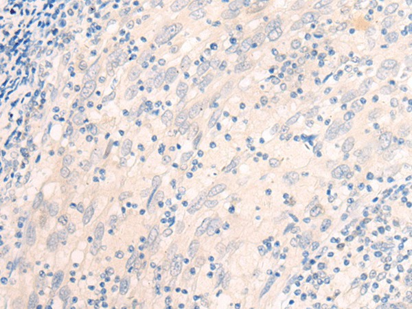 EME2 Polyclonal Antibody (E-AB-19801)