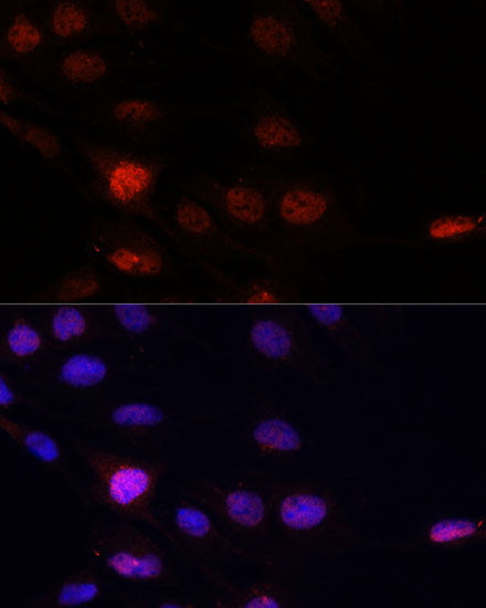 KLHL8 Polyclonal Antibody (E-AB-65150)