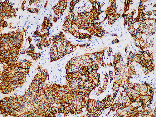 Her-2 Monoclonal Antibody (ELAB6637-M)