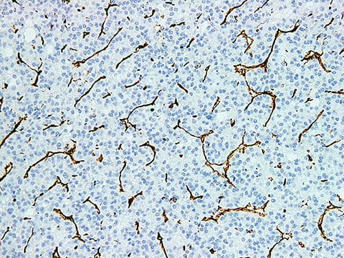 Vimentin Monoclonal Antibody (ELAB6529-M)