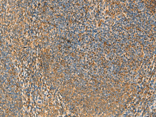 PPP1R1A Polyclonal Antibody (E-AB-18912)
