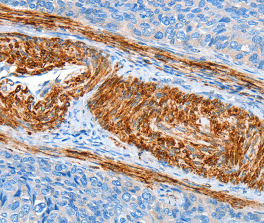 AARS Polyclonal Antibody (E-AB-16145)