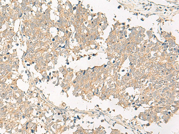 GPR161 Polyclonal Antibody (E-AB-18042)